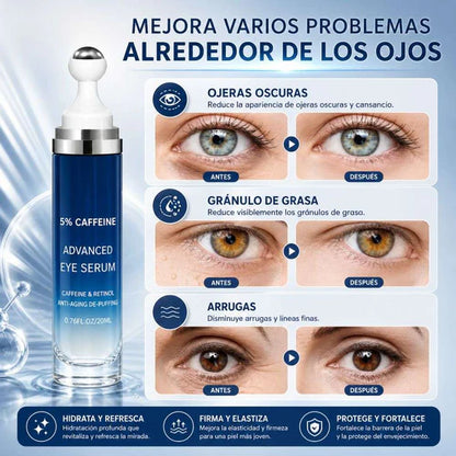 Eyelifth® ✨Serum de Cafeina al 5% 🫘 🧪 Recupera tu mirada y vuelve a darle vida a tu rostro 👁️❄️